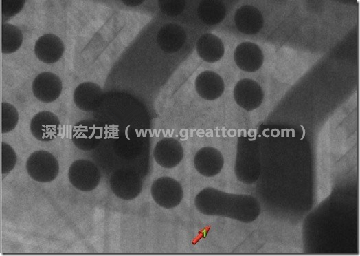BGA因?yàn)楹笁|變小，造成錫膏過(guò)多而最終形成焊接短路的結(jié)果。